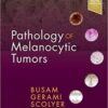 Pathology of Melanocytic Tumors PDF