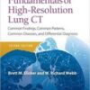 Fundamentals of High-Resolution Lung CT: Common Findings, Common Patterns, Common Diseases and Differential Diagnosis 2nd Edition PDF