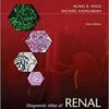 Diagnostic Atlas of Renal Pathology: Expert Consult - Online and Print, 2e