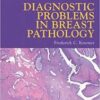 Diagnostic Problems in Breast Pathology, 1e