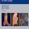 Thurlbeck's Pathology of the Lung 3rd edition Edition