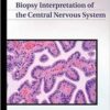 Biopsy Interpretation of the Central Nervous System (Biopsy Interpretation Series)