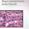 Biopsy Interpretation of the Thyroid (Biopsy Interpretation Series)