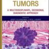 Soft Tissue Tumors: A Multidisciplinary, Decisional Diagnostic Approach