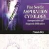 Fine Needle Aspiration Cytology: Interpretation and Diagnostic Difficulties 1st Edition
