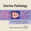 Uterine Pathology (Cambridge Illustrated Surgical Pathology) 1 Har/Cdr Edition