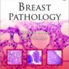 Breast Pathology (Consultant Pathology) 1st Edition