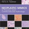 Neoplastic Mimics in Thoracic and Cardiovascular Pathology (Pathology of Neoplastic Mimics) 1st Edition