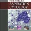 Atlas of Fine Needle Aspiration Cytology 1st Edition PDF