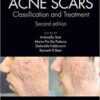 Acne Scars: Classification and Treatment, 2nd Edition PDF
