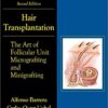 Hair Transplantation: The Art of Micrografting and Minigrafting, Second Edition 2nd Edition PDF