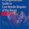 A Comprehensive Guide to Core Needle Biopsies of the Breast 1st