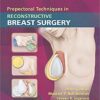 Prepectoral Techniques in Reconstructive Breast Surgery First Edition Epub