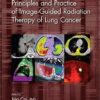 Principles and Practice of Image-Guided Radiation Therapy of Lung Cancer (Imaging in Medical Diagnosis and Therapy) 1st