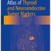 Atlas of Thyroid and Neuroendocrine Tumor Markers 1st