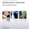 Challenging Concepts in Respiratory Medicine: Cases with Expert Commentary 1st