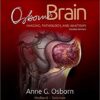 Osborn's Brain 2nd Edition