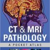 CT & MRI Pathology: A Pocket Atlas, Third Edition 3rd Edition