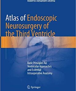 Atlas of Endoscopic Neurosurgery of the Third Ventricle: Basic Principles for Ventricular Approaches and Essential Intraoperative Anatomy