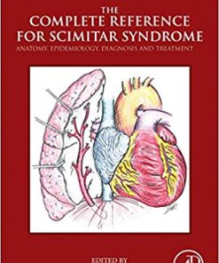 The Complete Reference for Scimitar Syndrome: Anatomy, Epidemiology, Diagnosis and Treatment 1st Edition