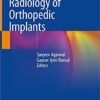 Radiology of Orthopedic Implants 1st ed. 2018 Edition PDF