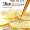 Atlas of Oral Microbiology: From Healthy Microflora to Disease 1st Edition