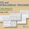 ECG and Intracardiac Tracings: A Toolkit Approach for Analyzing Arrhythmias, 2018 PDF