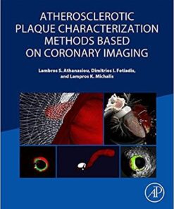 Atherosclerotic Plaque Characterization Methods Based on Coronary Imaging 1st
