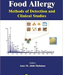 Food Allergy: Methods of Detection and Clinical Studies 1st