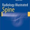 Radiology Illustrated: Spine 2014 Edition PDF
