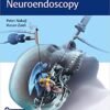 Controversies in Neuroendoscopy PDF