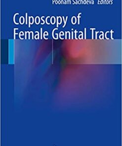 Colposcopy of Female Genital Tract 1st ed. 2017 Edition