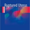 Ruptured Uterus 1st ed. 2017 Edition