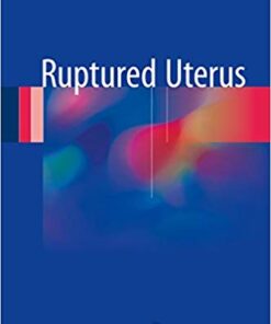 Ruptured Uterus 1st ed. 2017 Edition