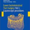 Lower Gastrointestinal Tract Surgery: Vol.1, Laparoscopic procedures (Springer Surgery Atlas Series)