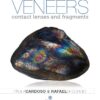 Ceramic veneers: contact lenses and fragments PDF