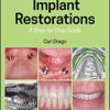Implant Restorations: A Step-by-Step Guide 4th Edition PDF