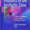 Implants in the Aesthetic Zone: A Guide for Treatment of the Partially Edentulous Patient 1st ed. 2019 Edition PDF