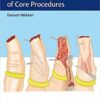 Hand Trauma: Illustrated Surgical Guide of Core Procedures Illustrated Edition PDF