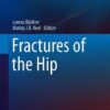 Fractures of the Hip (Fracture Management Joint by Joint) 1st ed. 2019 Edition PDF