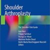Shoulder Arthroplasty: The Shoulder Club Guide 1st ed. 2020 Edition PDF