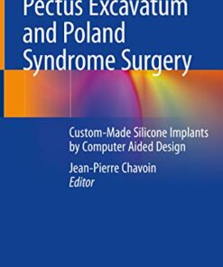 ​ Pectus Excavatum and Poland Syndrome Surgery: Custom-Made Silicone Implants by Computer Aided Design PDF