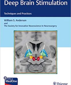 Deep Brain Stimulation: Techniques and Practices 1st Edition PDF