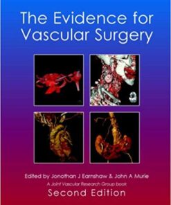 The Evidence for Vascular Surgery PDF