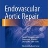 Endovascular Aortic Repair: Current Techniques with Fenestrated, Branched and Parallel Stent-Grafts 1st ed. 2017 Edition PDF