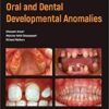 Atlas of Pediatric Oral and Dental Developmental Anomalies 1st Edition PDF