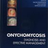 Onychomycosis: Diagnosis and Effective Management 1st Edition PDF