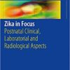 Zika in Focus: Postnatal Clinical, Laboratorial and Radiological Aspects 1st ed. 2017 Edition PDF