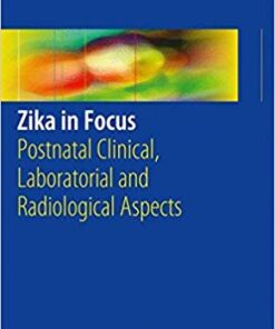 Zika in Focus: Postnatal Clinical, Laboratorial and Radiological Aspects 1st ed. 2017 Edition PDF