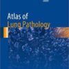 Atlas of Lung Pathology (Atlas of Anatomic Pathology) 1st ed. 2018 Edition PDF